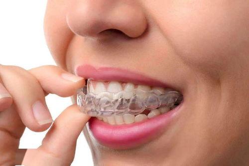 正畸14岁成人儿童视频,见证蜕变与自信的瞬间