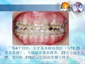 成人总磨牙怎么解决视频,视频揭秘止磨牙秘籍