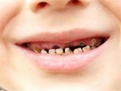 成人拔乳牙技巧视频教学,视频教学指南