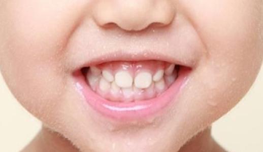 成人拔乳牙技巧视频教学,视频教学指南  第2张