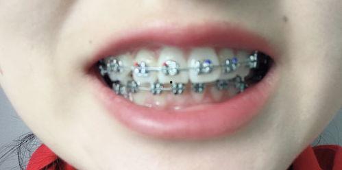 成人拔乳牙技巧视频教学,视频教学指南  第3张